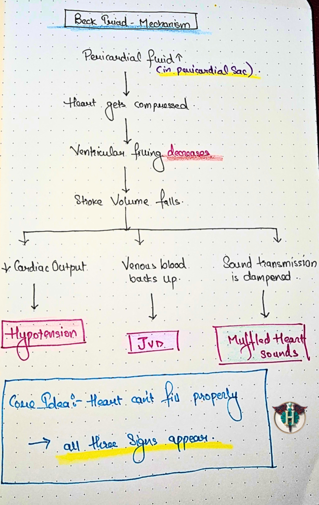 Mechanism of Beck Triad in cardiac tamponade showing impaired ventricular filling leading to reduced stroke volume, decreased cardiac output causing hypotension, venous backup causing jugular venous distension, and dampened sound transmission causing muffled heart sounds.